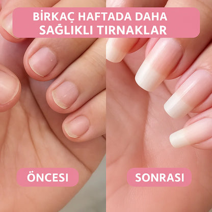 BerNail™ | Uzatıcı & Güçlendirici Bakım Yağı