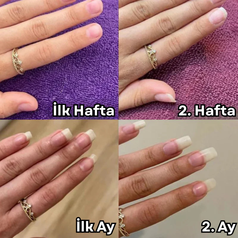 BerNail™ | Uzatıcı & Güçlendirici Bakım Yağı